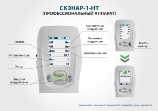 СКЭНАР-1-НТ (исполнение 01)  в Ельце купить Медицинская техника - denasosteo.ru 